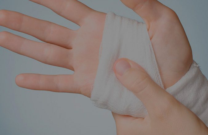 Cómo Tratar Quemaduras con Pólvora